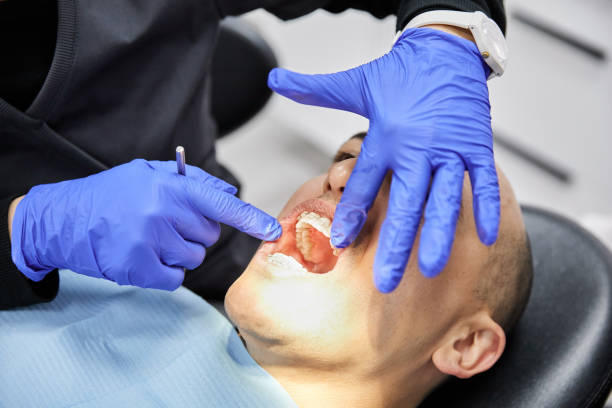 Best Root Canal Emergency Dentist  in Landover, MD